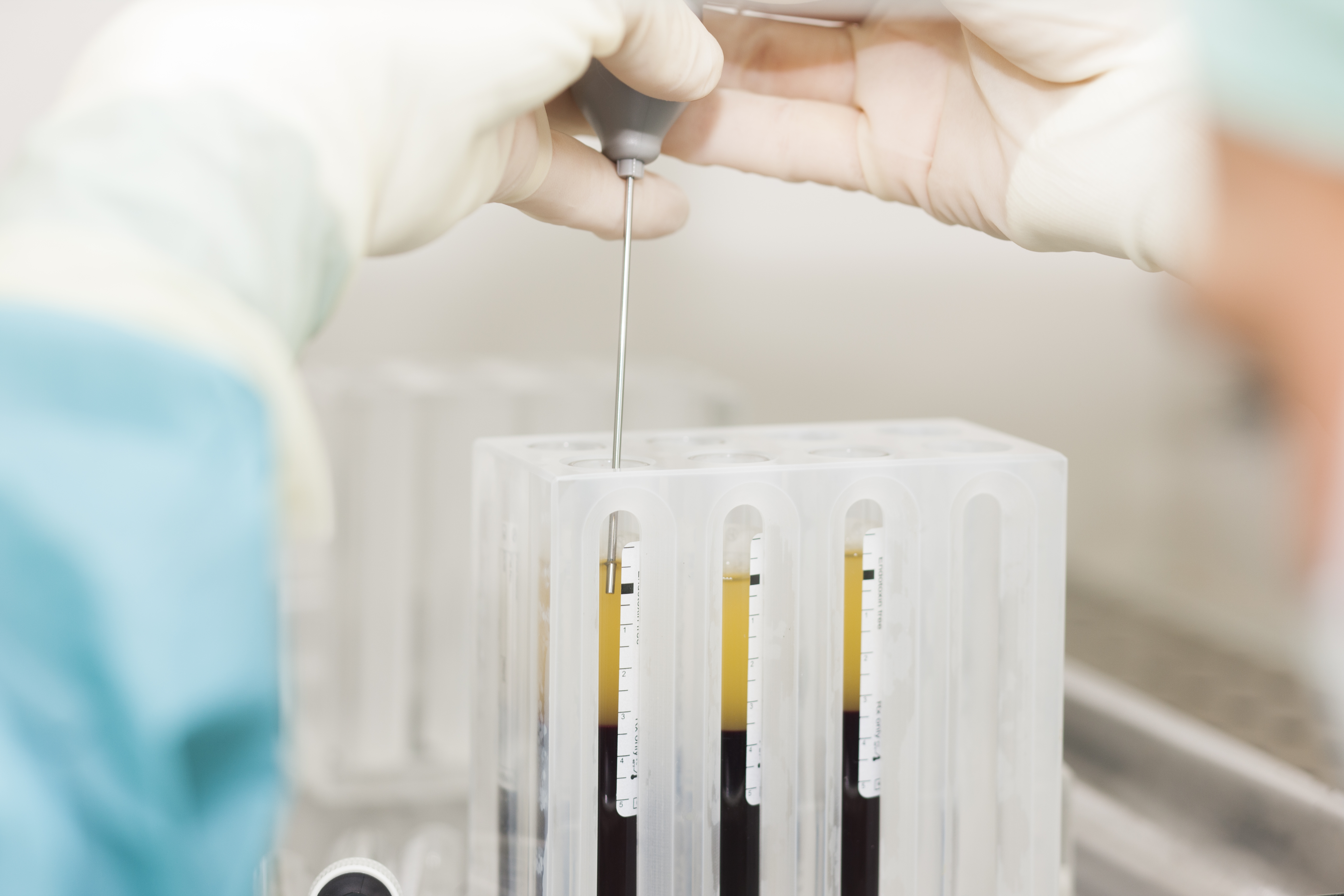 Advanced Biological Therapy Unit - PRP | Services | Hospital MiKS