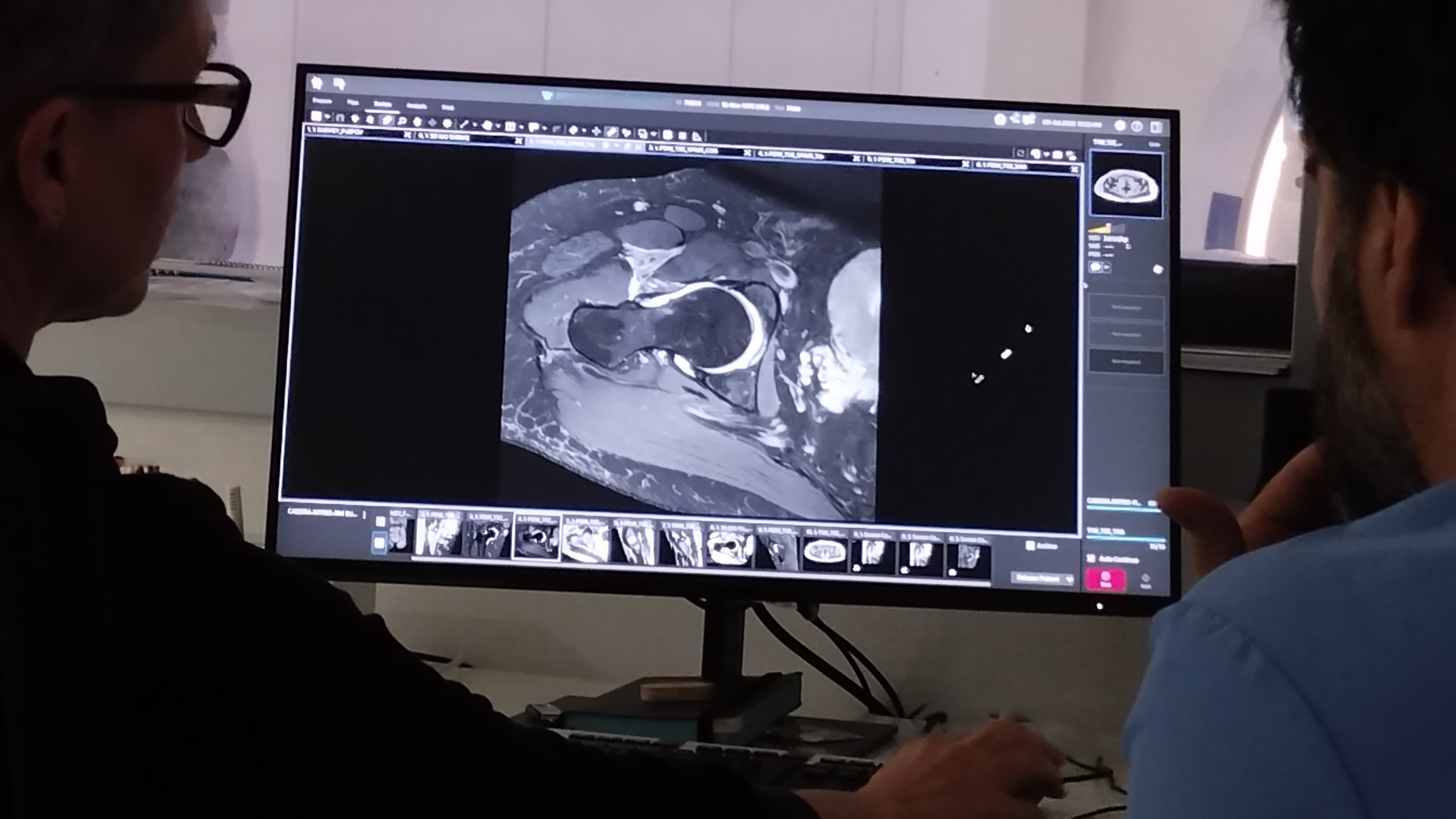 Radiólogo y t´cncio revisando prueba deresonancia magnética en Hospital MiKS