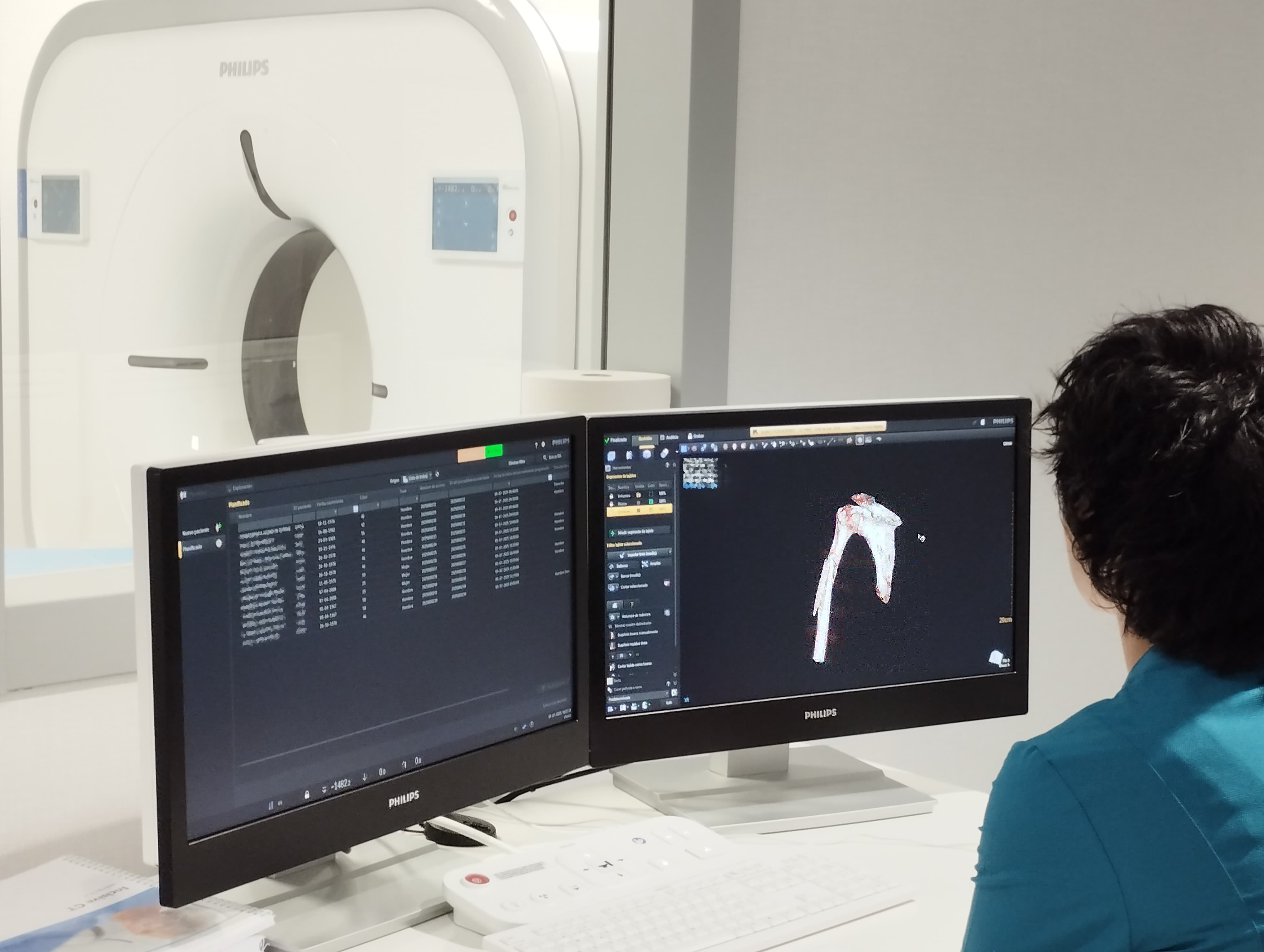 Tecnico de radiología visualizando una prueba TAC de humero roto en el Hospital MiKS